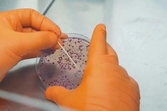 Ainia avanza en la detección y control de bacterias resistentes en alimentos